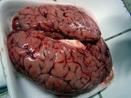 Cerebellum - picture no. 1